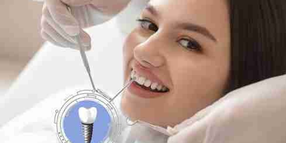 Tooth Replacement Services Backed by Expertise in Wolverhampton